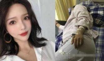 吃瓜孕妇事件视频下载安装