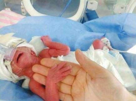 婴儿引产吃瓜事件视频